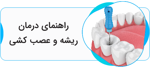 درمان ریشه