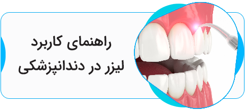 لیزر در دندانپزشکی