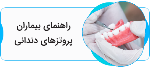 راهنمای پروتزهای دندانی